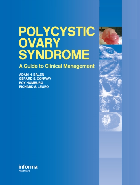 Polycystic Ovary Syndrome : A Guide to Clinical Management, EPUB eBook