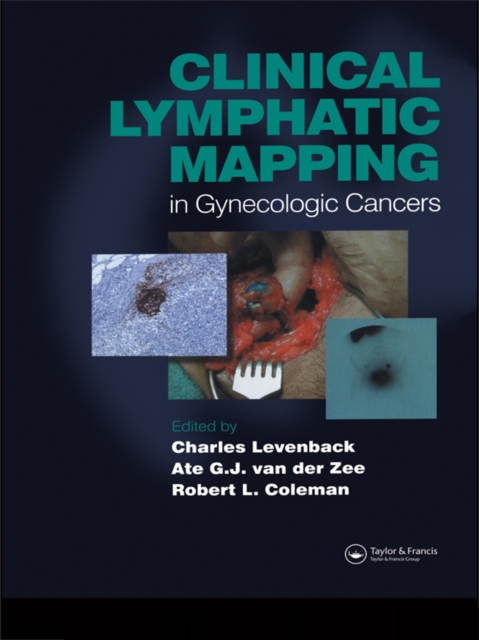 Clinical Lymphatic Mapping Of Gynecologic Cancer 9781135412241 6031