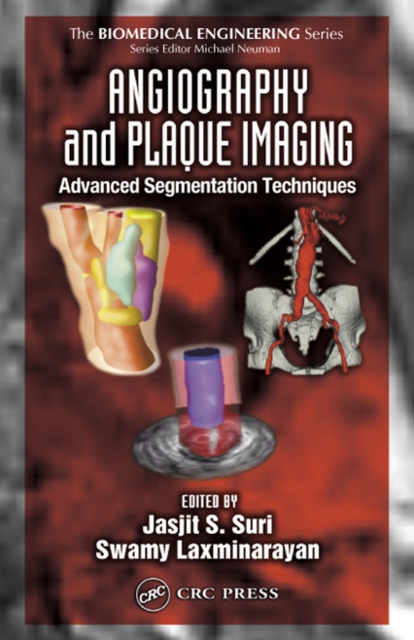 Angiography and Plaque Imaging : Advanced Segmentation Techniques, EPUB eBook
