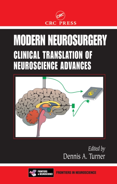 Modern Neurosurgery : Clinical Translation of Neuroscience Advances, EPUB eBook