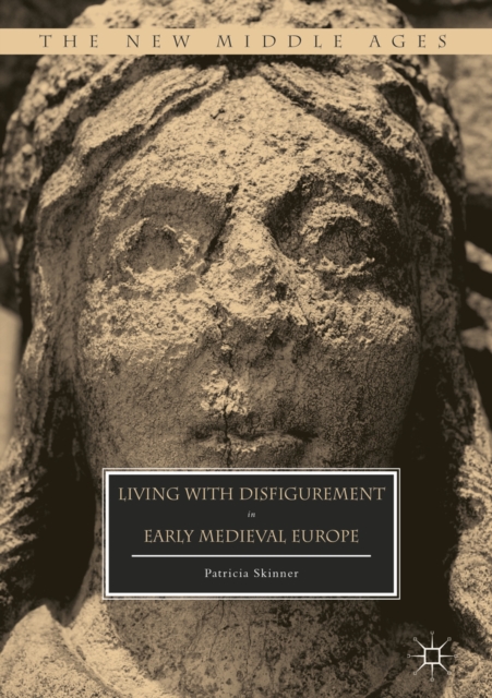 Living with Disfigurement in Early Medieval Europe, EPUB eBook