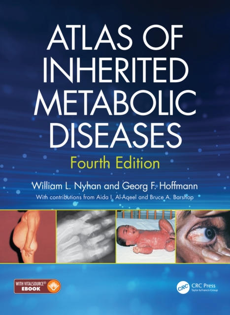 Atlas of Inherited Metabolic Diseases, EPUB eBook