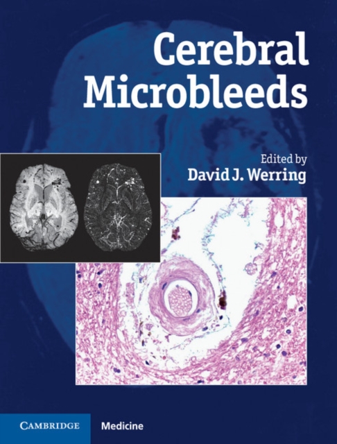 Cerebral Microbleeds : Pathophysiology to Clinical Practice, EPUB eBook