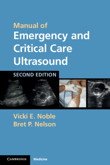 Manual of Emergency and Critical Care Ultrasound, EPUB eBook