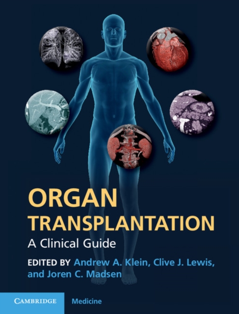 Organ Transplantation : A Clinical Guide, EPUB eBook