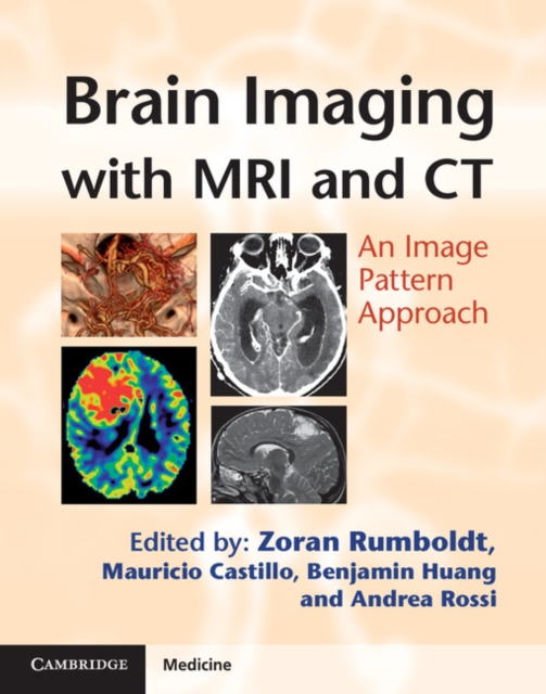 Brain Imaging with MRI and CT : An Image Pattern Approach, PDF eBook