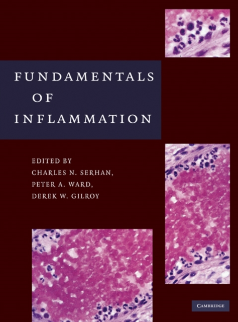 Fundamentals of Inflammation, EPUB eBook