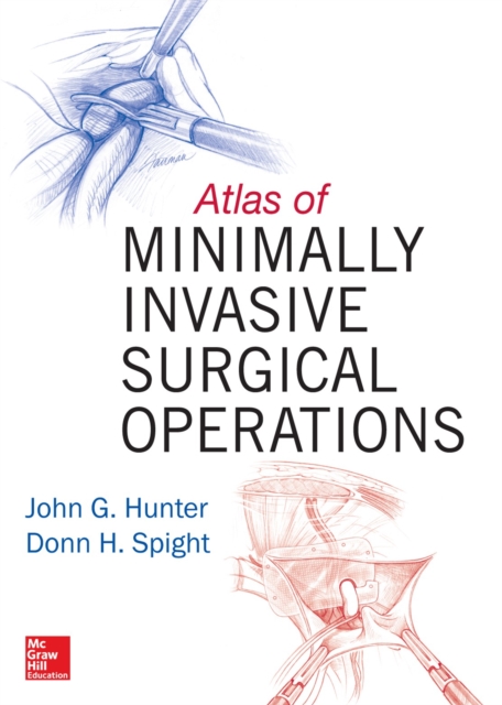 Atlas of Minimally Invasive Surgical Operations, EPUB eBook