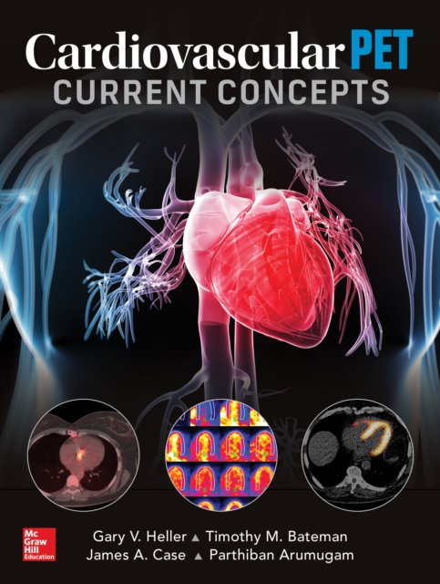 Cardiovascular PET: Current Concepts, EPUB eBook