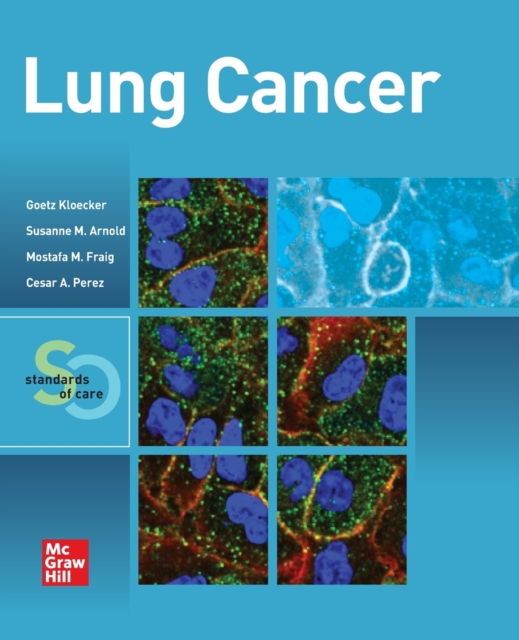 Lung Cancer:  Standards of Care, Paperback / softback Book
