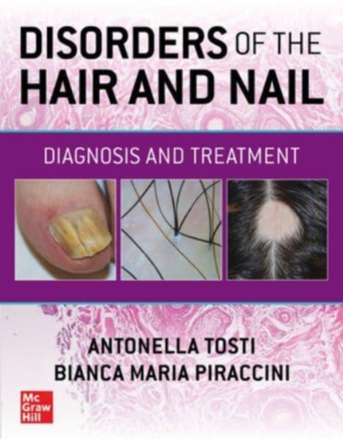 Disorders of the Hair and Nail: Diagnosis and Treatment, Paperback / softback Book