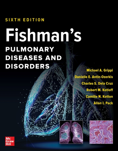 Fishman's Pulmonary Diseases and Disorders, 2-Volume Set, Sixth Edition, EPUB eBook
