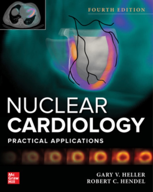 Nuclear Cardiology: Practical Applications, Fourth Edition, EPUB eBook