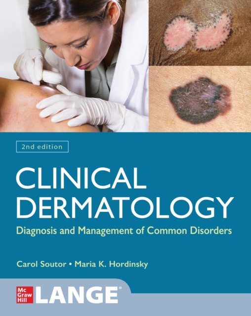 Clinical Dermatology: Diagnosis and Management of Common Disorders, Second Edition, EPUB eBook