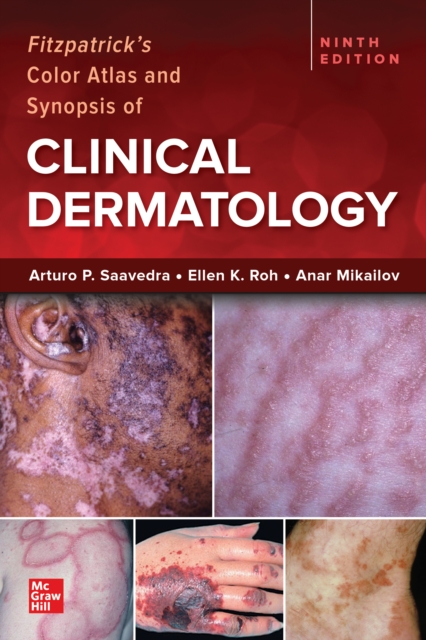 Fitzpatrick's Color Atlas and Synopsis of Clinical Dermatology, Ninth Edition, EPUB eBook