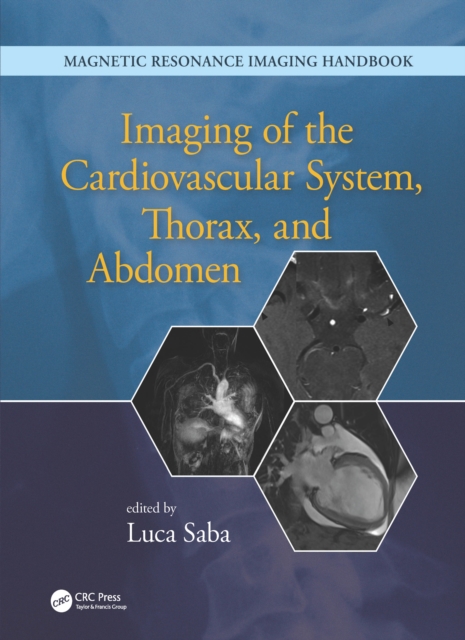 Imaging of the Cardiovascular System, Thorax, and Abdomen, EPUB eBook