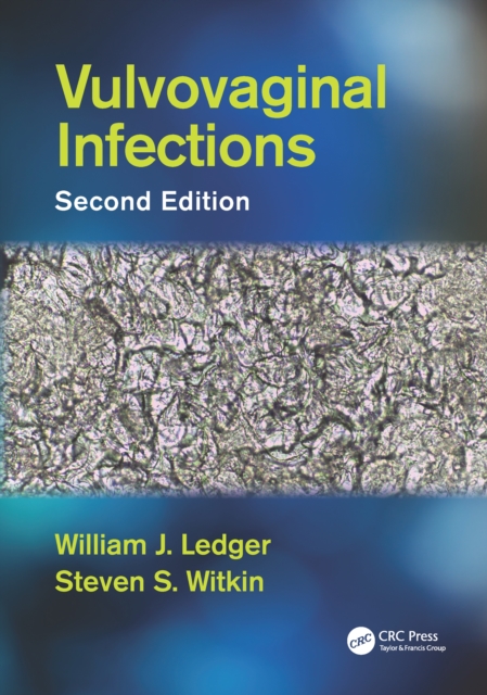 Vulvovaginal Infections, PDF eBook