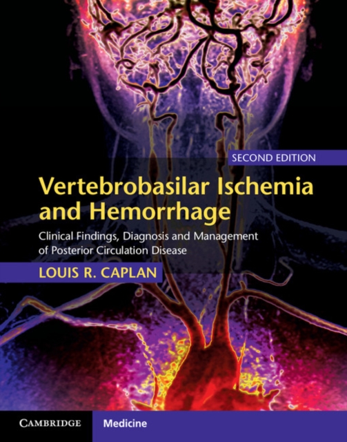 Vertebrobasilar Ischemia and Hemorrhage : Clinical Findings, Diagnosis and Management of Posterior Circulation Disease, PDF eBook