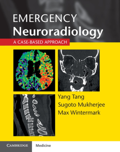 Emergency Neuroradiology : A Case-Based Approach, EPUB eBook