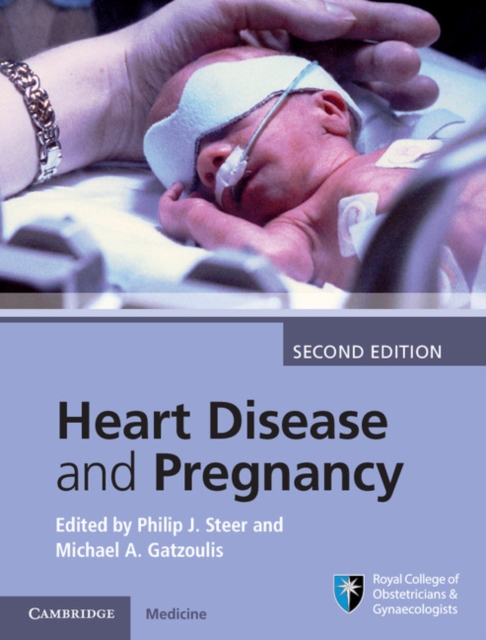 Heart Disease and Pregnancy, EPUB eBook