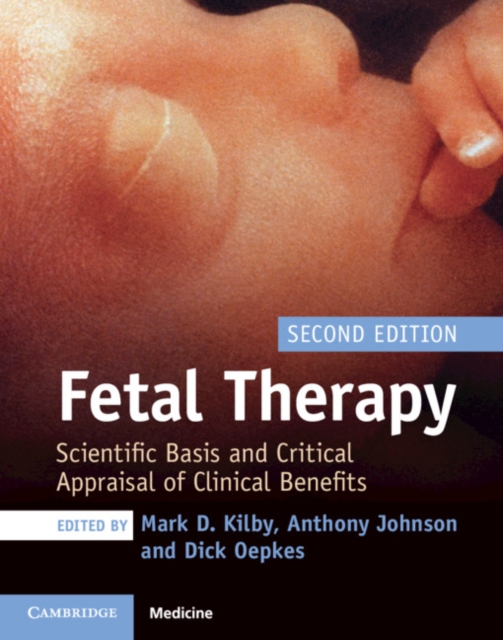 Fetal Therapy : Scientific Basis and Critical Appraisal of Clinical Benefits, PDF eBook
