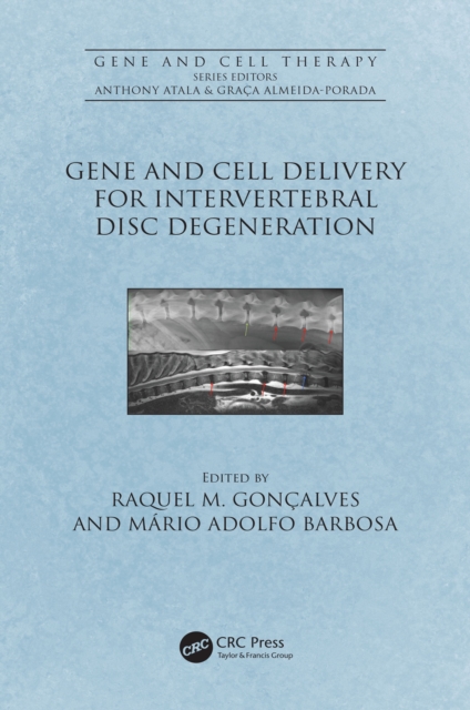 Gene and Cell Delivery for Intervertebral Disc Degeneration, EPUB eBook