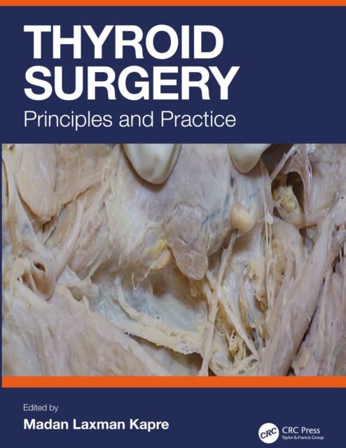 Thyroid Surgery : Principles and Practice, PDF eBook