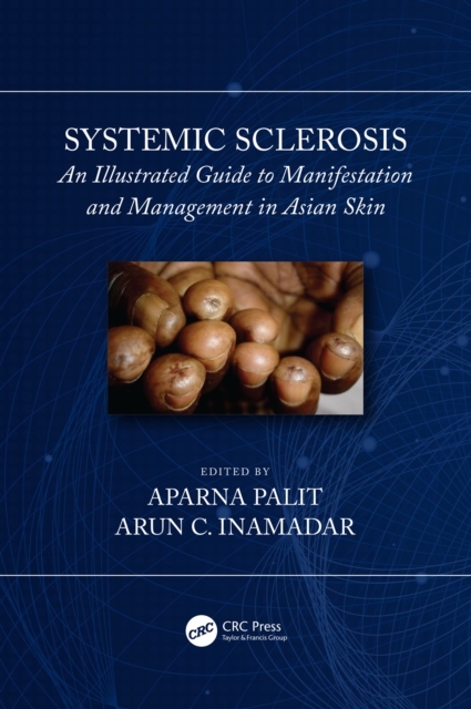 Systemic Sclerosis : An Illustrated Guide to Manifestation and Management in Asian Skin, EPUB eBook