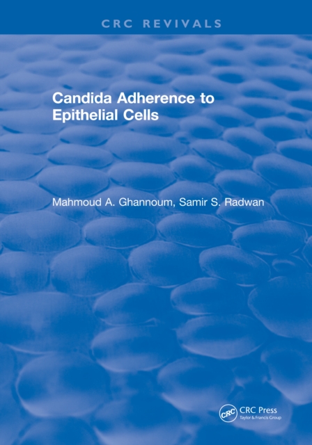 Candida Adherence to Epithelial Cells, PDF eBook