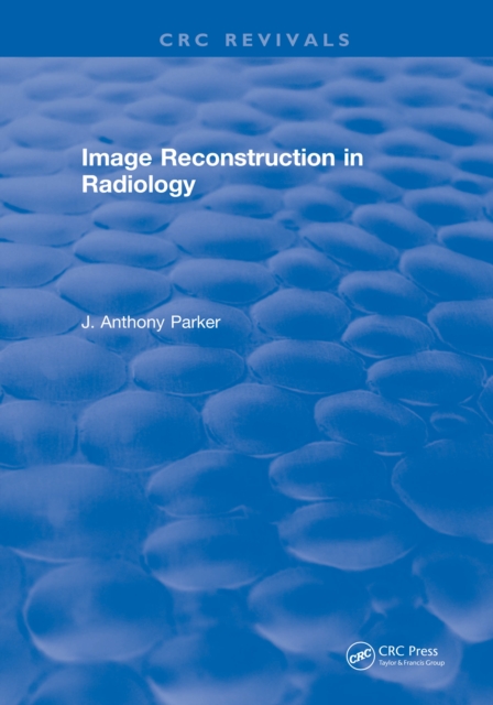 Image Reconstruction in Radiology, PDF eBook