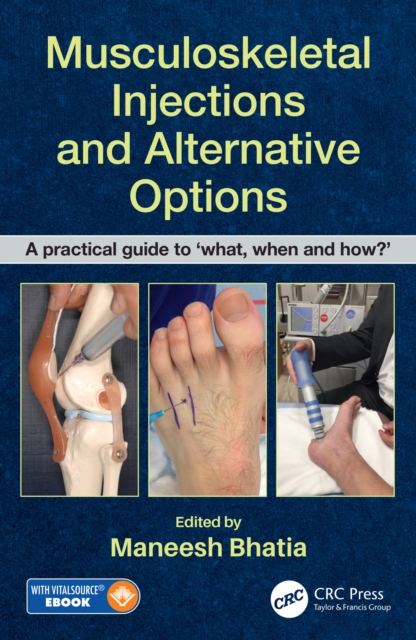 Musculoskeletal Injections and Alternative Options : A practical guide to 'what, when and how?', PDF eBook