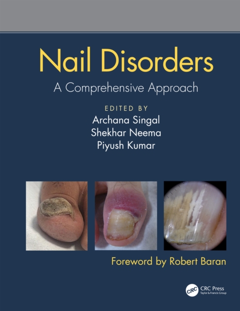 Nail Disorders : A Comprehensive Approach, PDF eBook