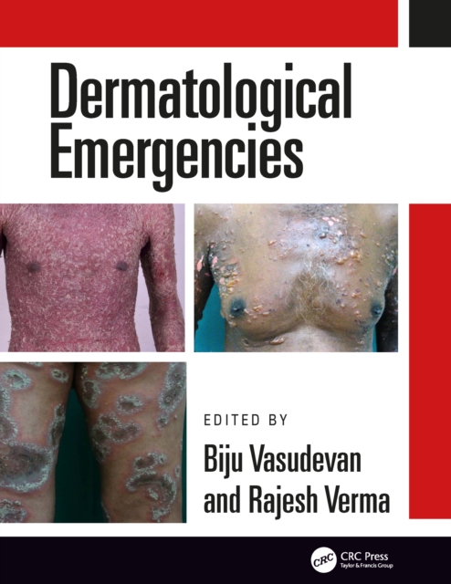 Dermatological Emergencies, EPUB eBook