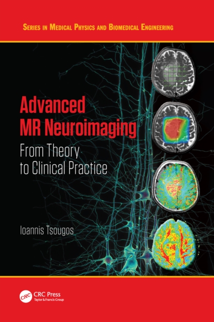 Advanced MR Neuroimaging : From Theory to Clinical Practice, EPUB eBook