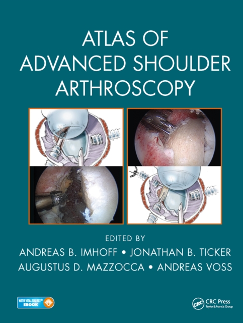 Atlas of Advanced Shoulder Arthroscopy, PDF eBook
