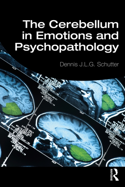 The Cerebellum in Emotions and Psychopathology, EPUB eBook