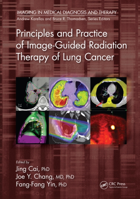 Principles and Practice of Image-Guided Radiation Therapy of Lung Cancer, EPUB eBook