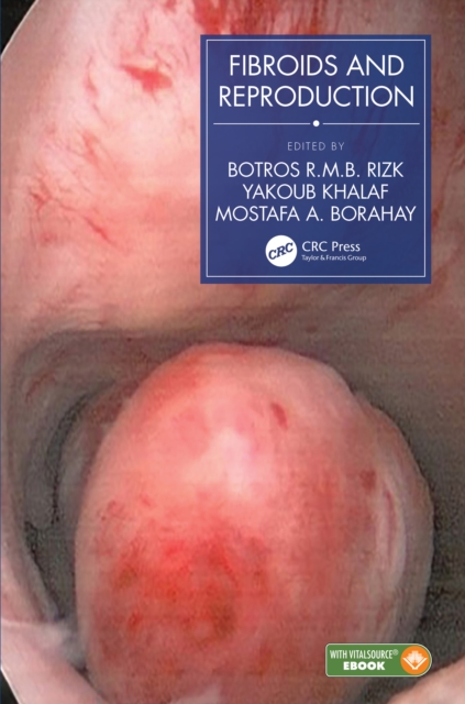 Fibroids and Reproduction, EPUB eBook