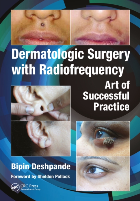Dermatologic Surgery with Radiofrequency : Art of Successful Practice, PDF eBook