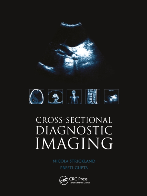 Cross-sectional Diagnostic Imaging : Cases for Self Assessment, EPUB eBook