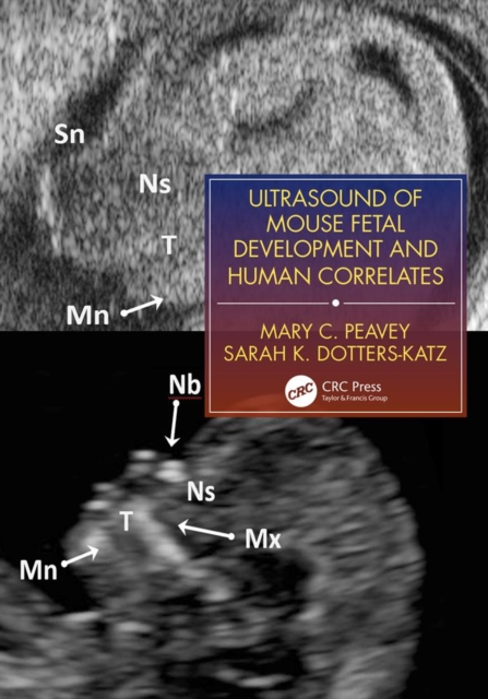 Ultrasound of Mouse Fetal Development and Human Correlates, EPUB eBook