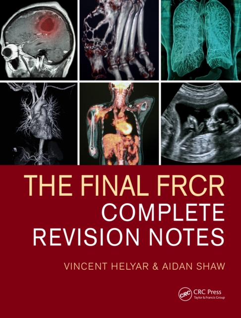 The Final FRCR : Complete Revision Notes, EPUB eBook