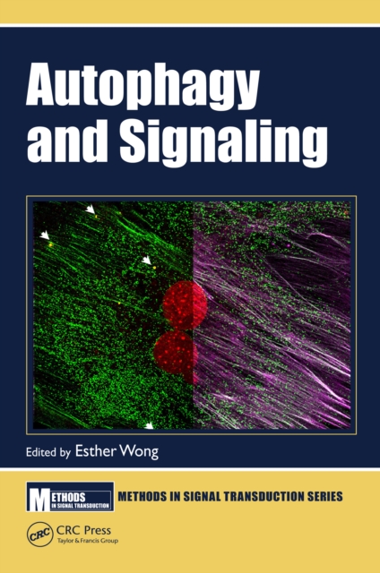 Autophagy and Signaling, EPUB eBook