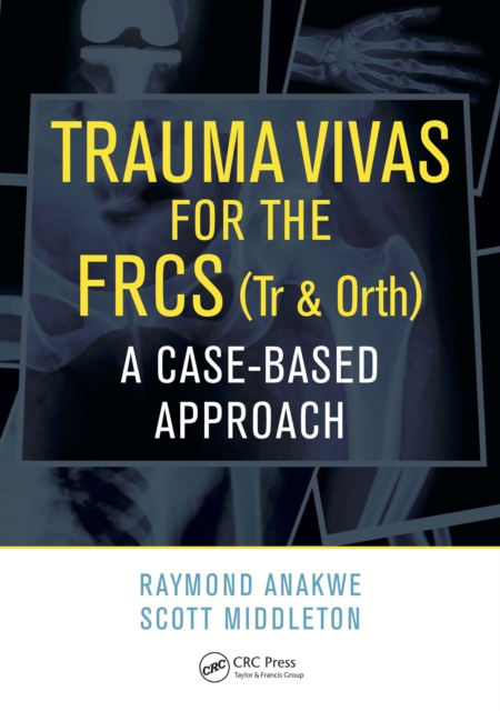 Trauma Vivas for the FRCS : A Case-Based Approach, EPUB eBook
