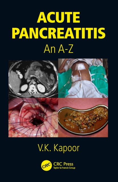 Acute Pancreatitis : An A-Z, EPUB eBook