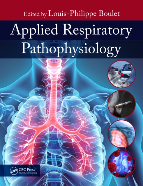 Applied Respiratory Pathophysiology, PDF eBook