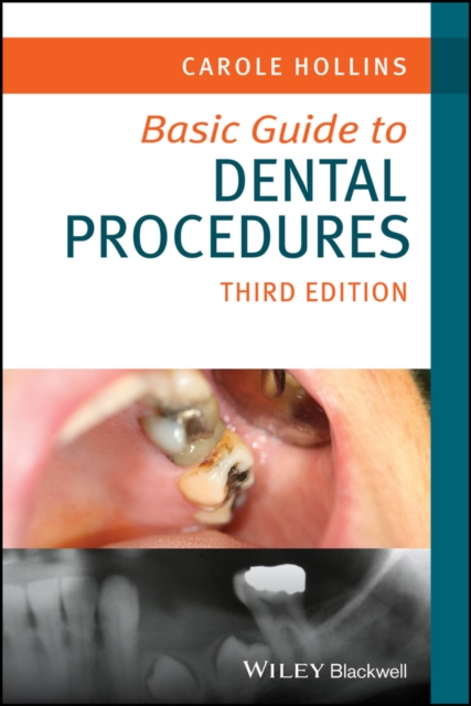 Basic Guide to Dental Procedures, EPUB eBook