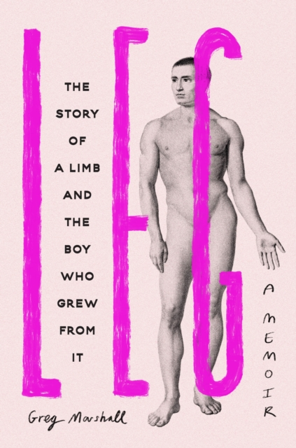 Leg : The Story of a Limb and the Boy Who Grew from It, EPUB eBook