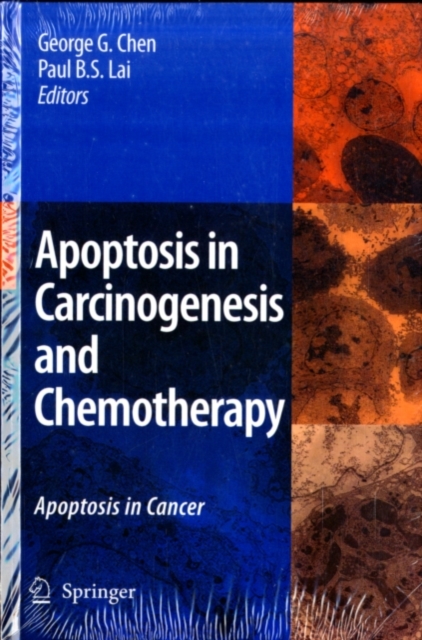 Apoptosis in Carcinogenesis and Chemotherapy : Apoptosis in cancer, PDF eBook
