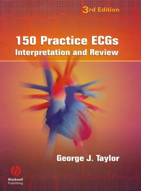 150 Practice ECGs : Interpretation and Review, Spiral bound Book